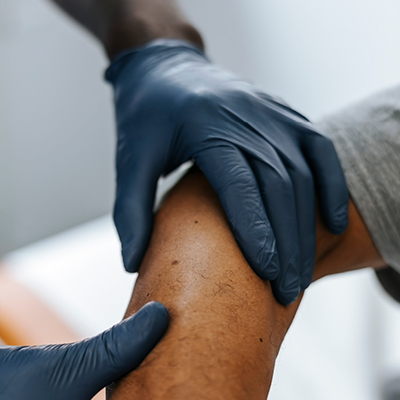 Close-up of a doctor in blue gloves examining a patient's leg for signs of melanoma.