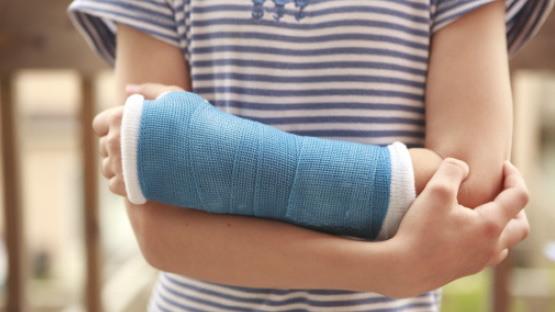 child holding their arm in a blue cast